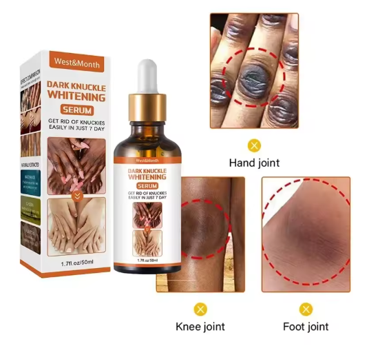 SERUM ACLARANTE CON NIACIMIDA