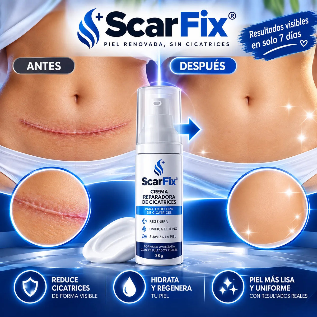 ScarFix®  ¡Elimina visiblemente las cicatrices en tan solo 7 días!