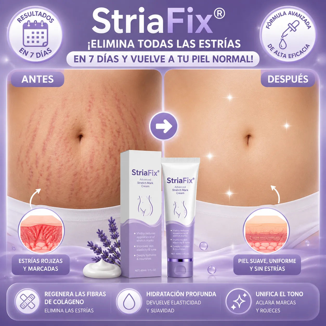 StriaFix® — ¡Elimina todas las estrías en 7 días y vuelve a tu piel normal!